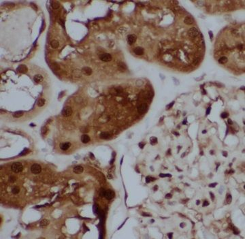 TBX2 Antibody