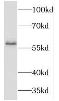 TBX6 Rabbit Polyclonal Antibody