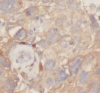 TBXAS1 Antibody