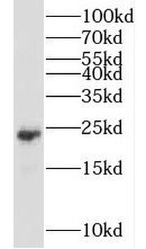 RHOQ Rabbit Polyclonal Antibody