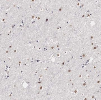 TCERG1 Antibody