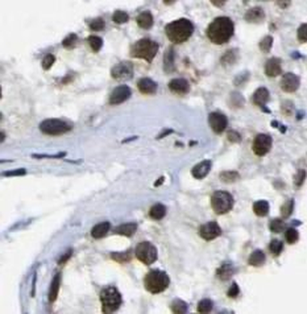 TCF4 Antibody