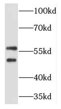 TCP11 Antibody