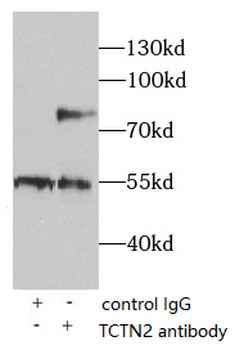 TCTN2 Antibody