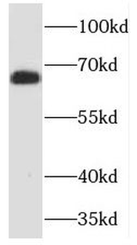 TCTN3 Rabbit Polyclonal Antibody
