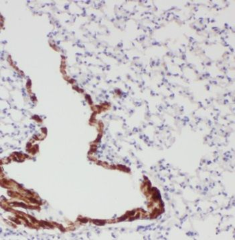 TCTN3 Rabbit Polyclonal Antibody