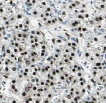 TEAD1 Antibody