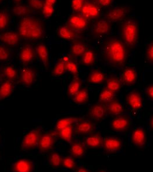 TEAD3 Antibody