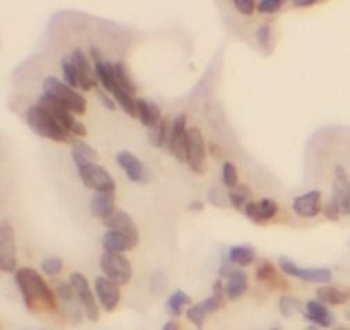 TEAD3 Antibody