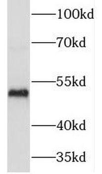 TEKT4 Rabbit Polyclonal Antibody