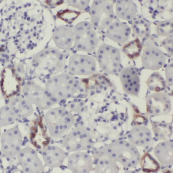 TEKT4 Rabbit Polyclonal Antibody