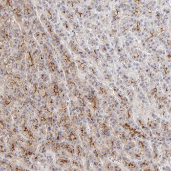TNXB Antibody