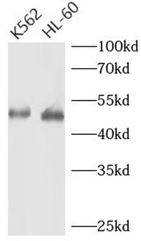 TERF1 Antibody