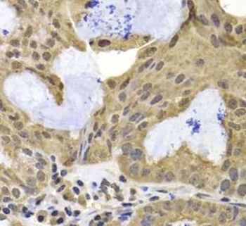 TERF2IP Rabbit Polyclonal Antibody