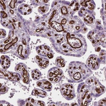 TET2 Antibody