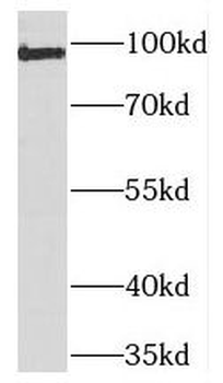 TEX10 Rabbit Polyclonal Antibody
