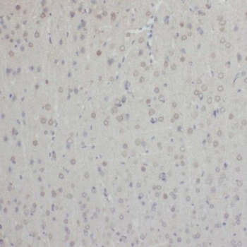 TEX10 Rabbit Polyclonal Antibody