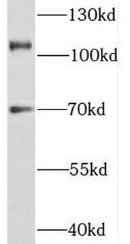 TEX11 Rabbit Polyclonal Antibody