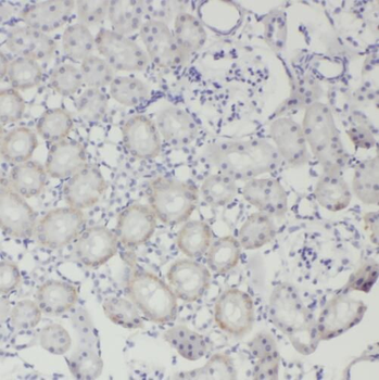 TEX11 Rabbit Polyclonal Antibody