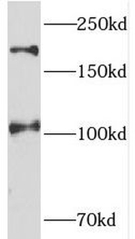 TEX14 Rabbit Polyclonal Antibody