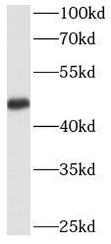 TFAP2A Rabbit Polyclonal Antibody