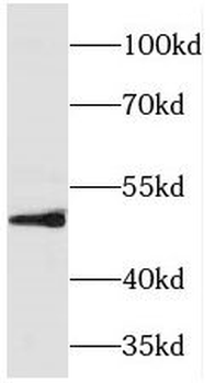 TFAP2B Antibody