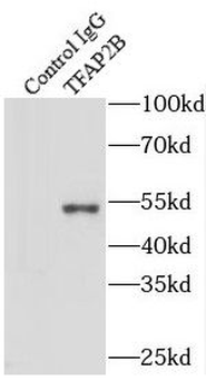 TFAP2B Antibody