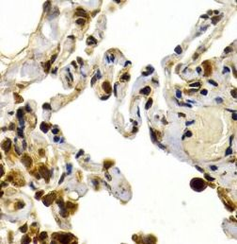 TFDP1 Antibody