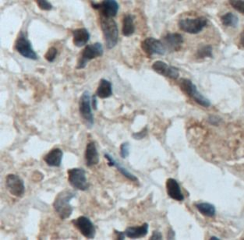TFE3 Antibody
