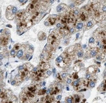 TFF2 Antibody