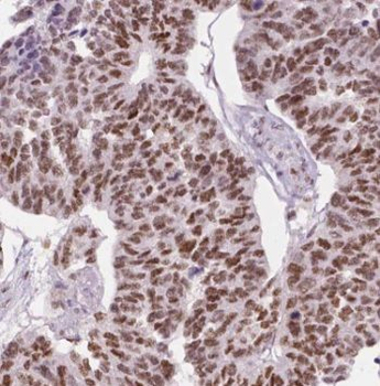 GTF2I Antibody