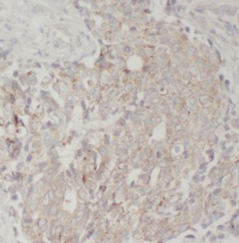TGFA Rabbit Polyclonal Antibody