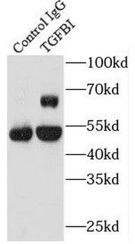 TGFBI Antibody