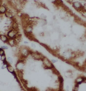 TGFBI Antibody