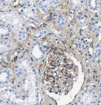 TGFBRAP1 Antibody