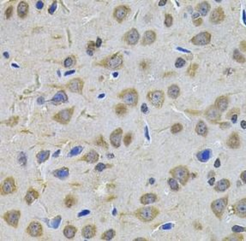 TGM1 Antibody