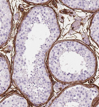 TGM4 Antibody