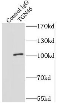 TGOLN2 Antibody