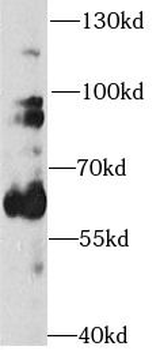 TH Rabbit Polyclonal Antibody