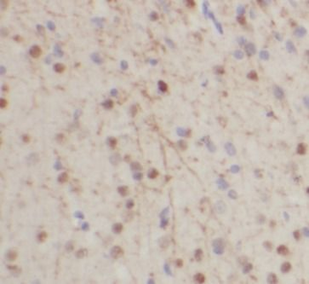 TH Rabbit Polyclonal Antibody