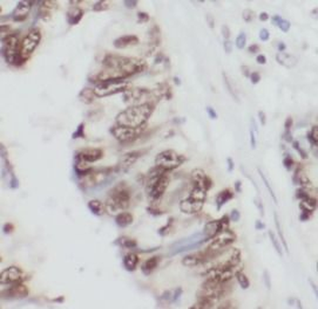 THAP1 Antibody