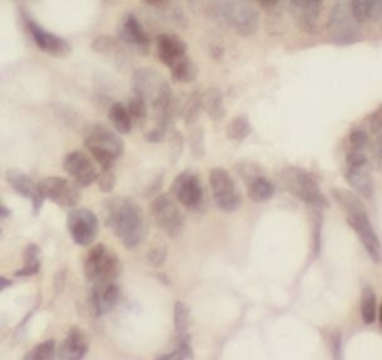 THOC1 Antibody
