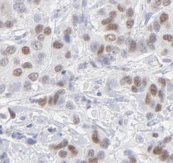 THOC5 Antibody