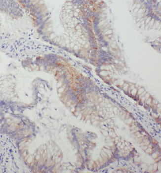 THOP1 Antibody