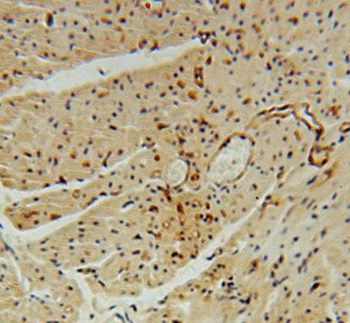 THBD Rabbit Polyclonal Antibody