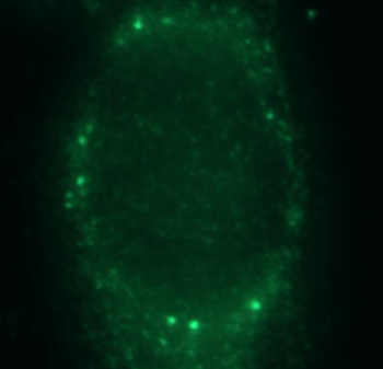 THRSP Antibody