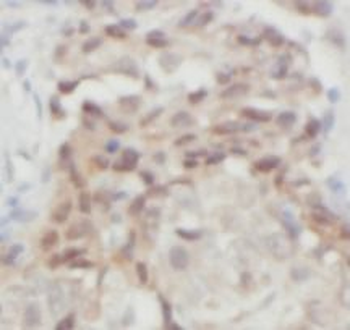 THRSP Antibody