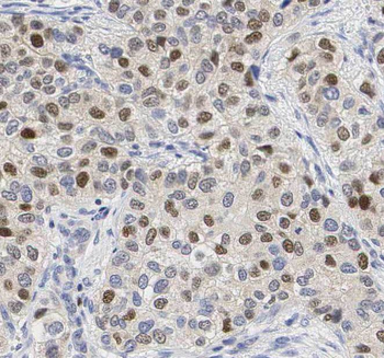 THUMPD1 Antibody