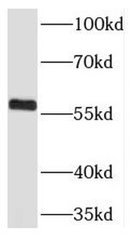 THUMPD3 Antibody