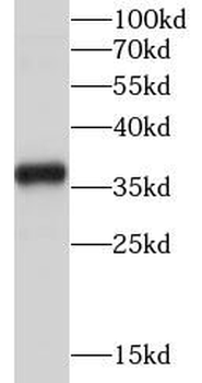 TYMS Antibody
